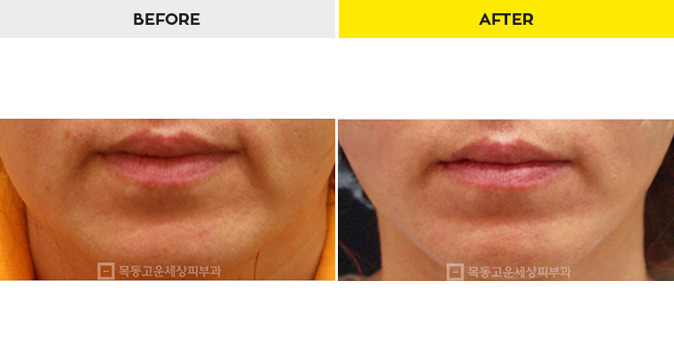 2cadce28130f1a3ea5b58edadea9d97b_1467163