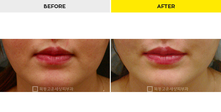 2cadce28130f1a3ea5b58edadea9d97b_1467163