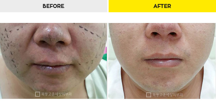 aeddfdb14865ad542bd6f4b2420b7272_1469703