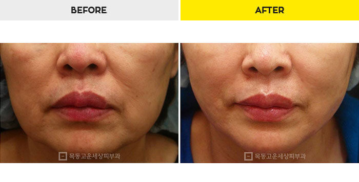 3ea7101076eb589ac168001a657046b3_1470218