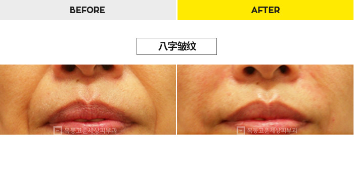 76b9073a20e3334c81a64570a5d1bda7_1470278