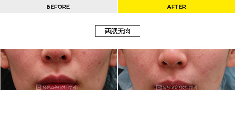 76b9073a20e3334c81a64570a5d1bda7_1470278