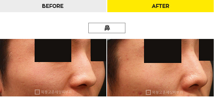 76b9073a20e3334c81a64570a5d1bda7_1470278