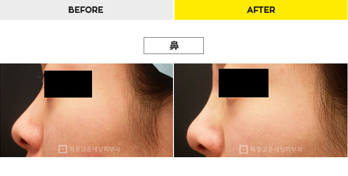 76b9073a20e3334c81a64570a5d1bda7_1470278