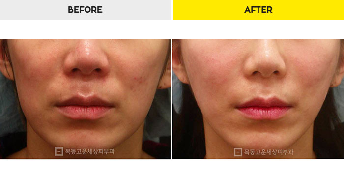 76b9073a20e3334c81a64570a5d1bda7_1470278