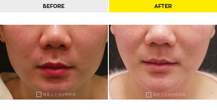 76b9073a20e3334c81a64570a5d1bda7_1470279