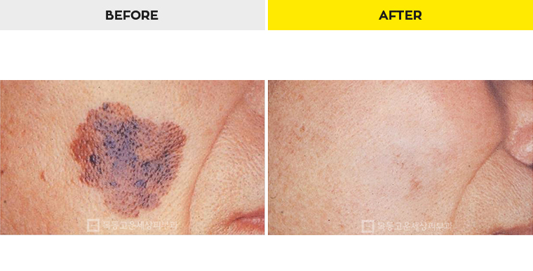 76b9073a20e3334c81a64570a5d1bda7_1470279