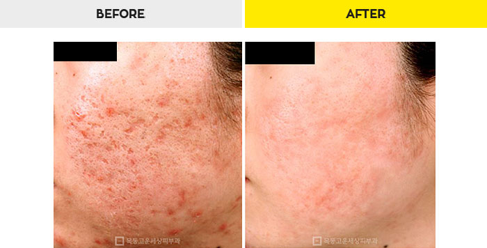 76b9073a20e3334c81a64570a5d1bda7_1470279