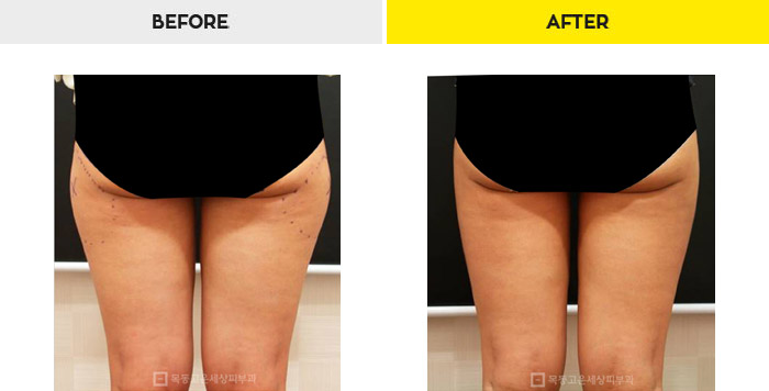 76b9073a20e3334c81a64570a5d1bda7_1470280