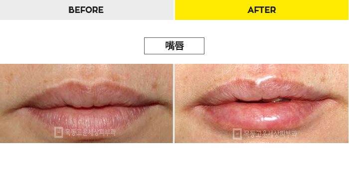 76b9073a20e3334c81a64570a5d1bda7_1470277