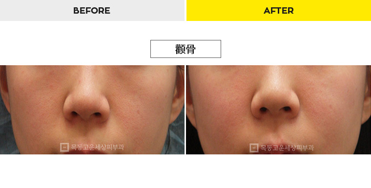 76b9073a20e3334c81a64570a5d1bda7_1470278