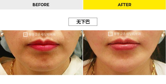 76b9073a20e3334c81a64570a5d1bda7_1470278