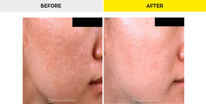 76b9073a20e3334c81a64570a5d1bda7_1470279