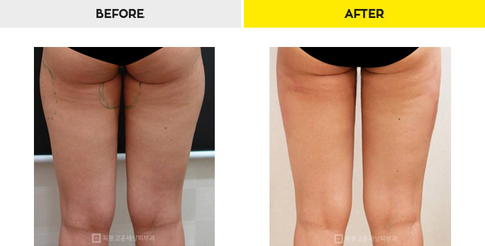 76b9073a20e3334c81a64570a5d1bda7_1470279