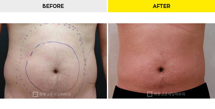 76b9073a20e3334c81a64570a5d1bda7_1470280