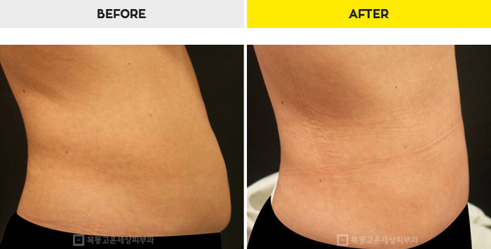 76b9073a20e3334c81a64570a5d1bda7_1470280