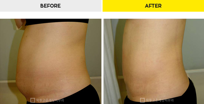 76b9073a20e3334c81a64570a5d1bda7_1470280